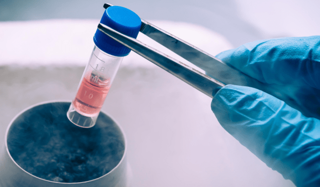 Un ensayo de terapia con células madre, prometedor contra esclerósis múltiple progresiva