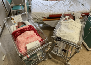 Separan con éxito a dos niñas siamesas en España: la operación duró cinco horas y participaron 20 médicos