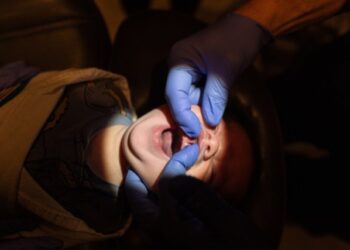 El floreciente negocio de cortar la lengua de los bebés en Idaho