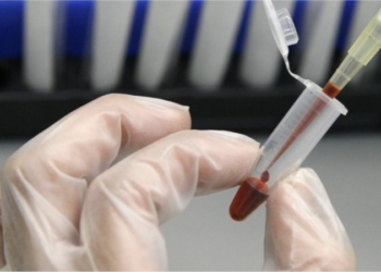 Gran preocupación por el aumento de casos de VIH entre la comunidad latina de EEUU.