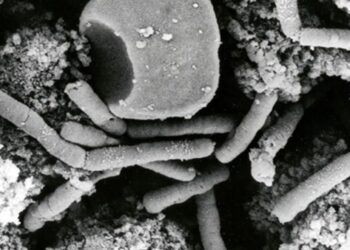 ¿Qué es el ántrax? La enfermedad de la que alerta de un brote la OMS: muy peligrosa y mortal