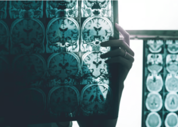 ¿Es posible determinar quién desarrollará la enfermedad de Alzheimer?