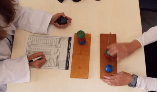 Estos síntomas pueden alertar de la esclerosis múltiple hasta cinco años antes del diagnóstico