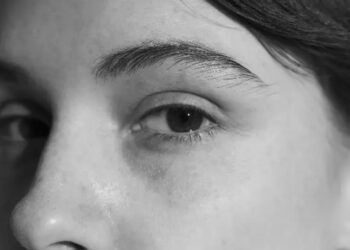 Acromatopsia: la extraña condición que hace ver todo en blanco y negro