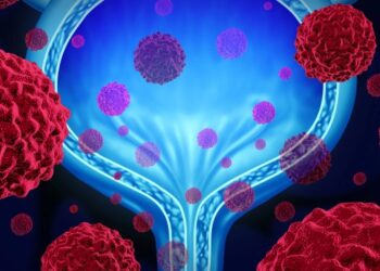 Lo que no se habla del cáncer de vejiga