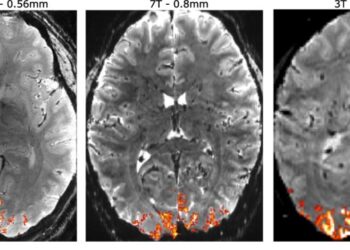 Todos los secretos que esconde la mente de los psicópatas