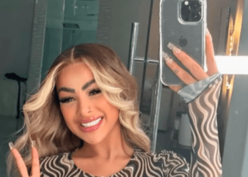 Filtran devastadora imagen de  Yailin “la más viral” con heridas en su rostro… ¿Qué pasó?