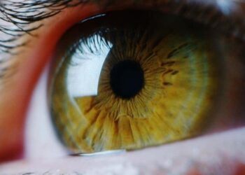 Se hizo un examen de la vista y descubrió que ha tenido una astilla clavada en la córnea durante 15 años