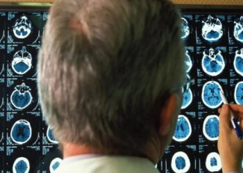 Un análisis de sangre permite diagnosticar el alzhéimer con una precisión del 95 %