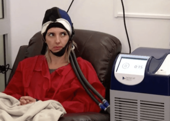 Tratamiento con gorras frías puede evitar la caída del pelo durante la quimioterapia