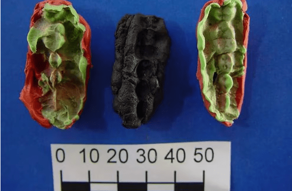 Estudio reveló que la mala salud bucodental agobiaba al hombre hace diez mil años