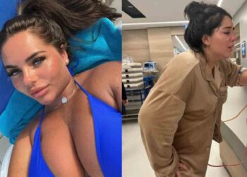 Modelo de OnlyFans casi pierde los senos tras someterse a una mala cirugía