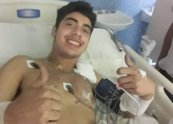 “Se me apagó la luz”: El dramático relato del joven que fue impactado por un rayo y vivió para contarlo