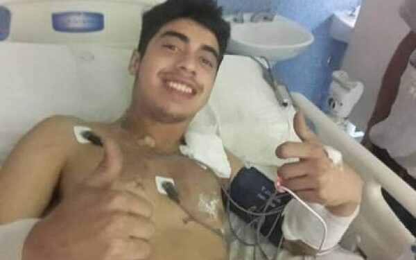 “Se me apagó la luz”: El dramático relato del joven que fue impactado por un rayo y vivió para contarlo