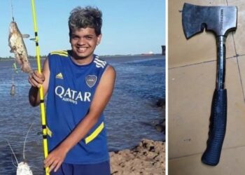 Brutal ataque en una fiesta de quinceaños: invitado recibió un hachazo en la cabeza