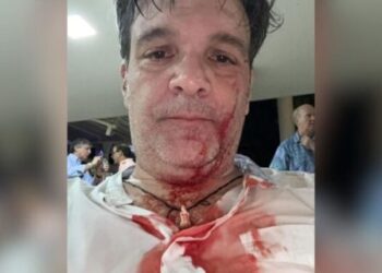 Ricardo Cusanno denunció agresión en una trifulca en la fiesta de Año Nuevo del Club Playa Azul