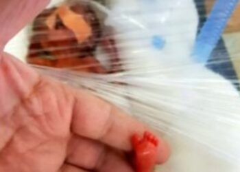 Salvaron a la “Bebé pluma”: pesaba 250 gramos al nacer y ya está en su casa