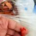 Salvaron a la “Bebé pluma”: pesaba 250 gramos al nacer y ya está en su casa