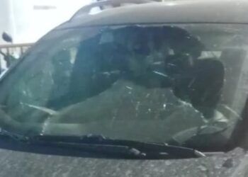 Mujer quiso incendiar el carro de su ex, pero terminó quemando a su hijo de dos años