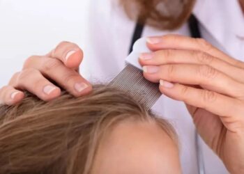 Es vegana, su hija tiene piojos y se niega a sacarlos por una insólita razón