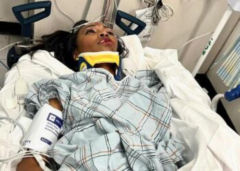 Imágenes sensibles: Actriz de “Black Panther” y “Avengers”, gravemente herida tras ser atropellada