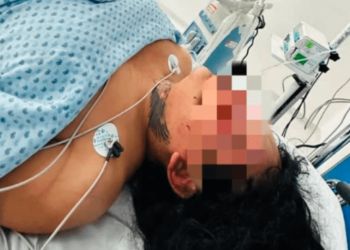 Hacen públicas las imágenes de cómo quedó la influencer Paolita Suarez tras la golpiza que le dio su prometido