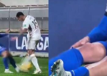 Imágenes sensibles: escalofriante falta en España le abrió la tibia a un futbolista en pleno partido