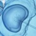 Lo que significa el fallo del Tribunal Supremo de Alabama sobre la fecundación in vitro