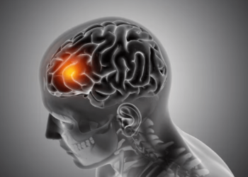 Por qué el estrés aumenta el riesgo de ACV: Cinco recomendaciones para prevenirlo