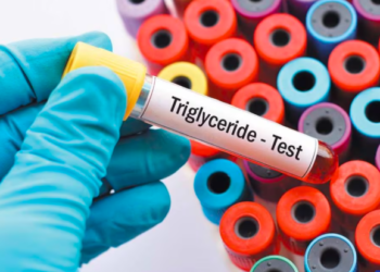 Cuáles son las causas de tener triglicéridos altos y cuáles son los niveles considerados normales
