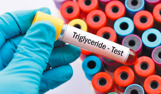Cuáles son las causas de tener triglicéridos altos y cuáles son los niveles considerados normales