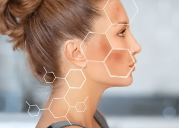 ¿Cómo usar la vaselina para reducir las manchas y arrugas de la piel?