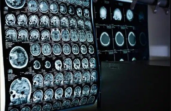 Precios de resonancias magnéticas en Caracas alcanzan cifras alarmantes