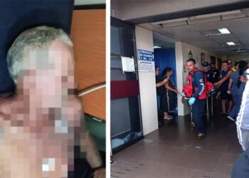 Sexagenario sobrevivió a la descarga de un cable de alta tensión que lo dejó suspendido en Zulia