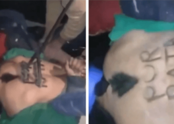 Vecinos atraparon a un ladrón y lo quemaron con un fierro como si fuera ganado (Imágenes sensibles)