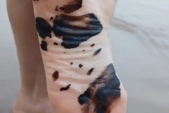 Oil spill in Anzoátegui State has affected the beaches of Lechería