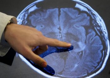 Niño de 13 años es el primer curado de un tumor cerebral terminal en el mundo