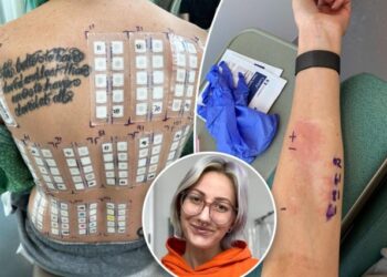 ¿Alergia al sexo? La extraña enfermedad que le impide a una estadounidense disfrutar el “delicioso”