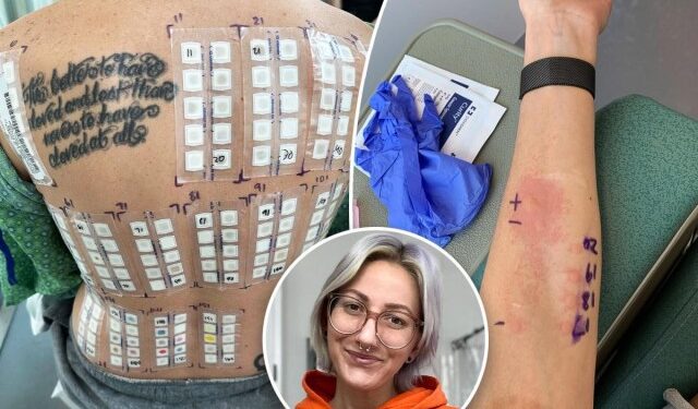 ¿Alergia al sexo? La extraña enfermedad que le impide a una estadounidense disfrutar el “delicioso”