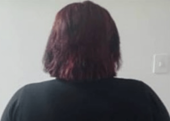 Se acabaron las andanzas de una falsa doctora que inyectaba labios y glúteos en El Tigre