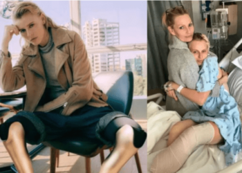 La historia de la exitosa modelo que perdió las dos piernas por no quitarse un tampón