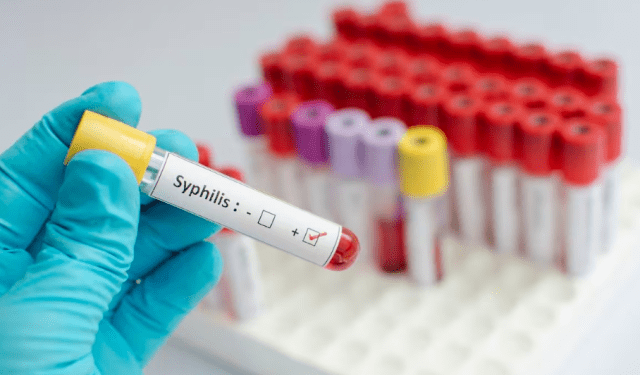 ONG alerta de que tres de cada 10 migrantes en la frontera sur de México tienen sífilis