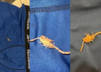 Un hombre se hospedó en un hotel cinco estrellas de Las Vegas pero sus vacaciones se arruinaron porque un escorpión lo picó en los testículos