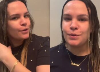 VIRAL: venezolana contó por qué se le comenzó a caer el cabello poco tiempo después de llegar a EEUU (VIDEO)