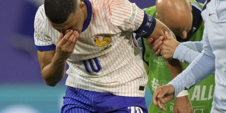 Mbappé no será operado y jugará la Eurocopa 2024 con una máscara facial