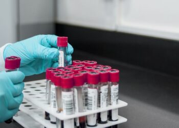 Confirman primer caso de Oropouche en Italia importado de Cuba