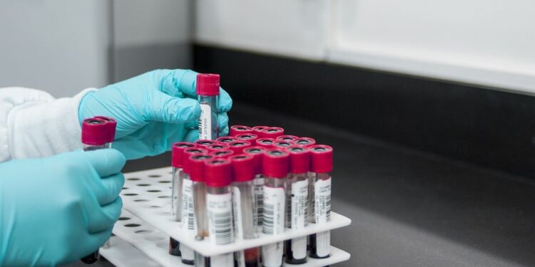 Confirman primer caso de Oropouche en Italia importado de Cuba