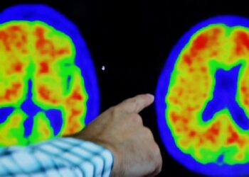 El fármaco contra el Alzheimer de Eisai y Biogen sufre un revés en Europa