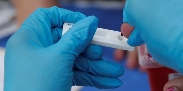 Alemán en remisión cinco años después de tratamiento experimental contra el VIH