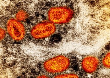Suecia reporta primer caso de forma más infecciosa de viruela símica